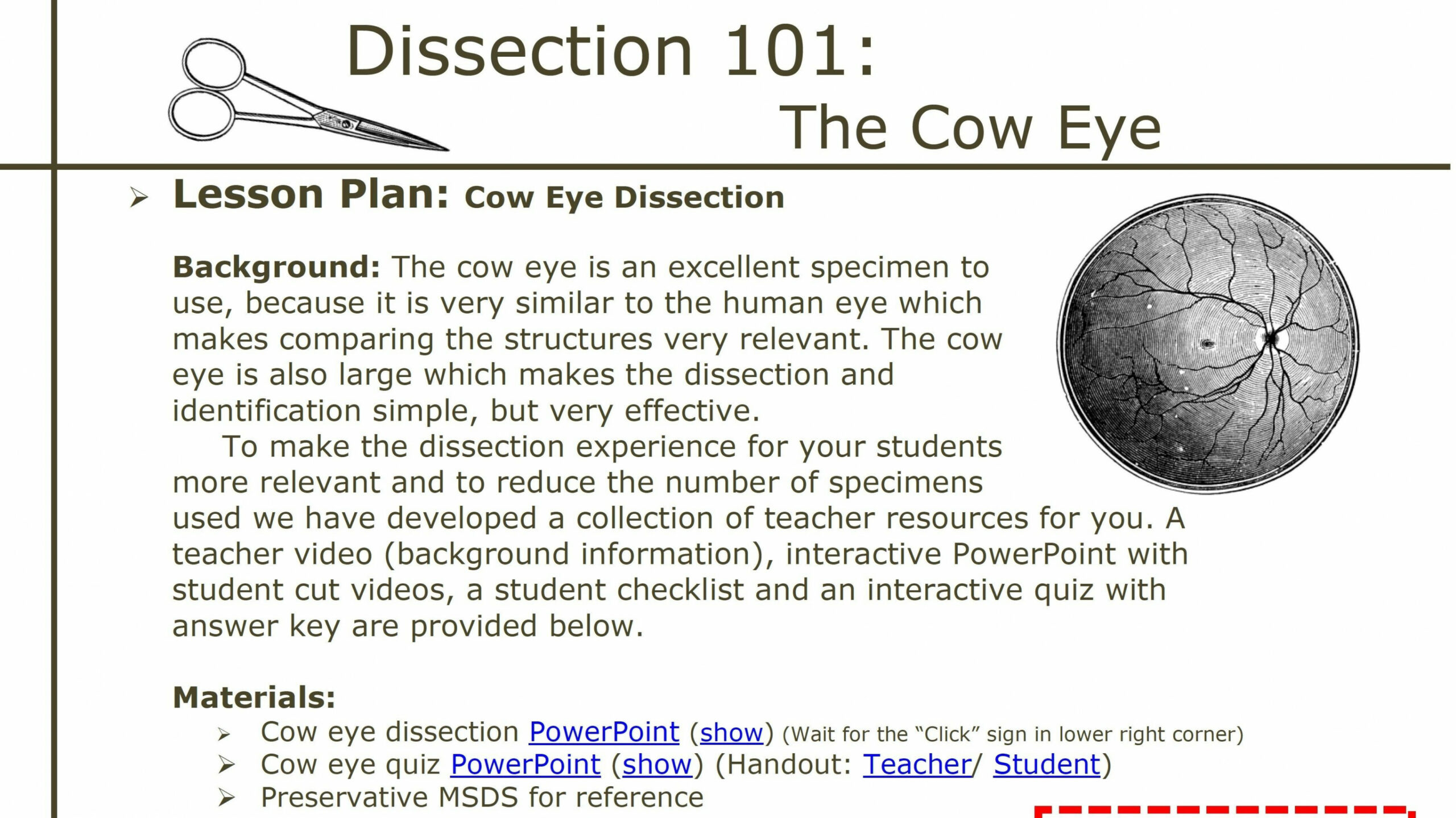 Dissection   Cow Eye Dissection: Lesson Plan  PBS LearningMedia