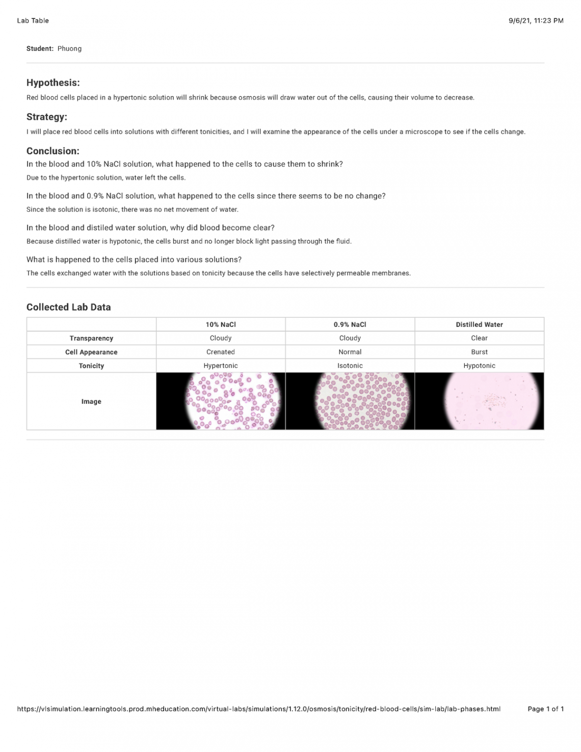 Osmosis - Tonicity in red blood cells - Lab Table //, : PM